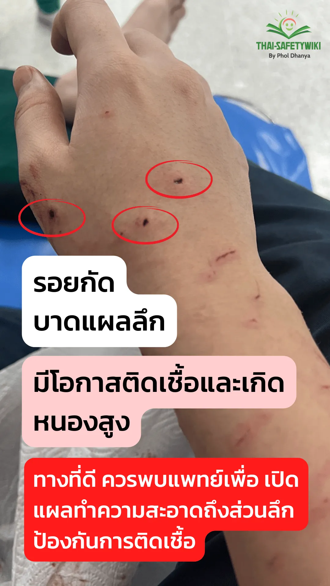 บาดแผล ที่ถูกแมวกัด แมวข่วน อันตรายกว่าที่คุณคิด