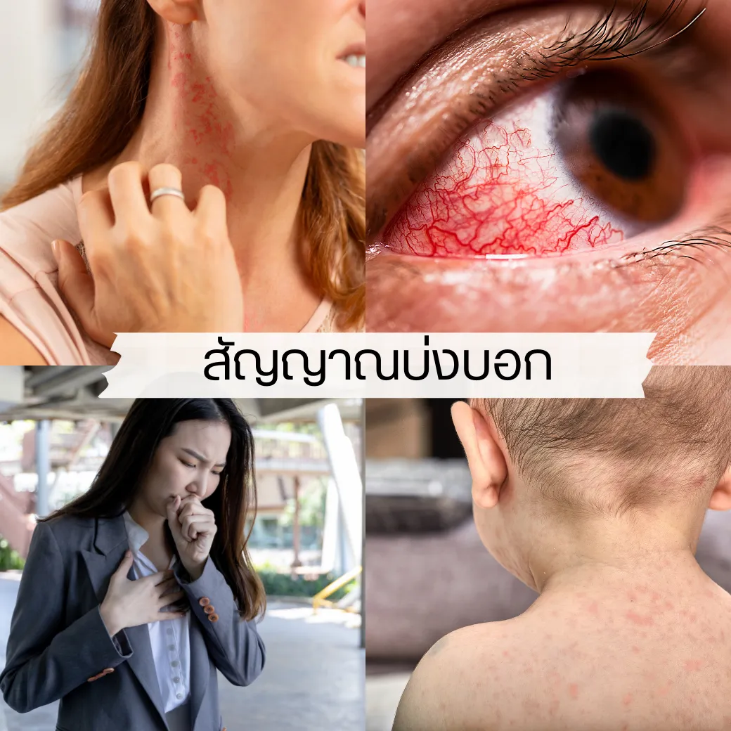 โควิดสายพันธุ์ใหม่ XBB.1.16 อาร์คตูรุส