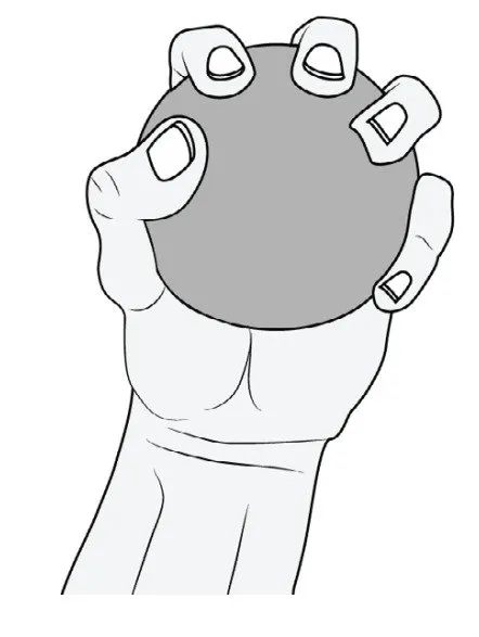 เอ็นกล้ามเนื้ออักเสบบริเวณข้อศอก (Tennis elbow, Golfer elbow)