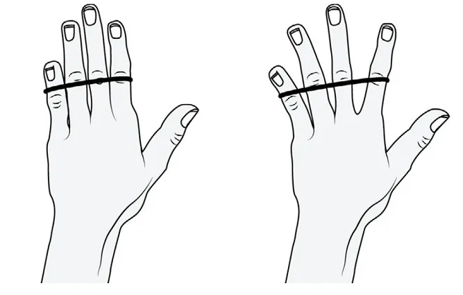 เอ็นกล้ามเนื้ออักเสบบริเวณข้อศอก (Tennis elbow, Golfer elbow)