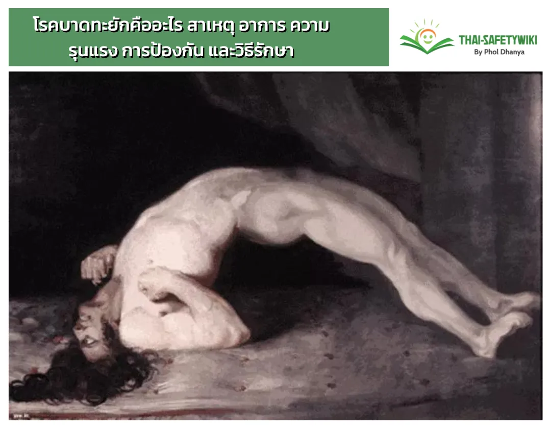 โรคบาดทะยักคืออะไร สาเหตุ อาการ ความรุนแรง การป้องกัน และวิธีรักษา