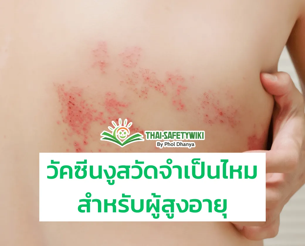 วัคซีนงูสวัดจำเป็นไหมสำหรับผู้สูงอายุ